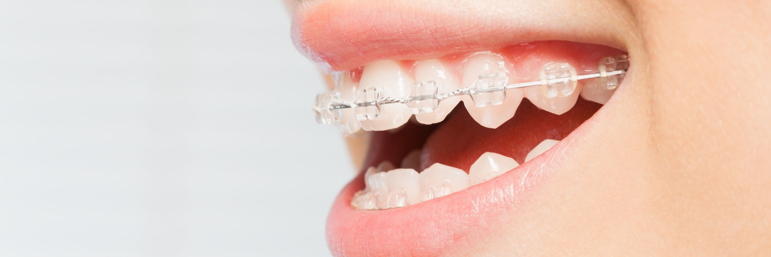 Cabinet dentaire république - Dentiste Belleville sur Meuse - Orthodontie